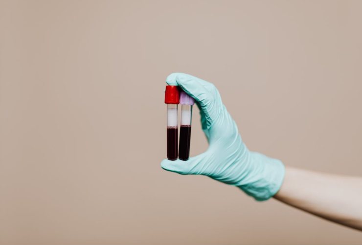 Gli esami del sangue e la prevenzione